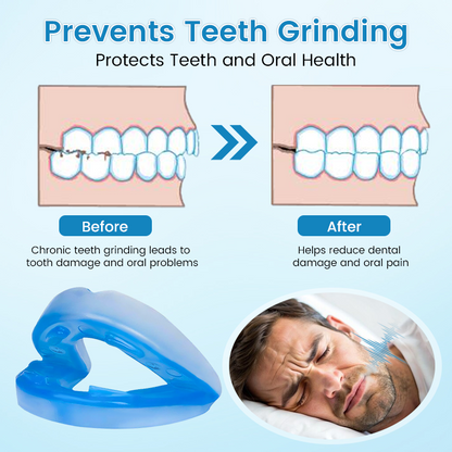 LAST DAY SALE 60% OFF ⏰ PerfectSleep Solution – Snore-Reducing & Teeth-Grinding Guard